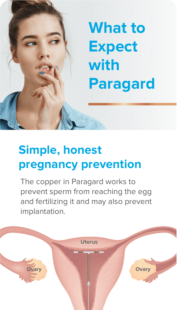 Dark-hard woman thinking and looking to the left at the words: What to expect with paragard; illustrated image of uterus and ovaries with Paragard IUD inserted.